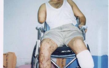 ياسر أبو العيش ‫(1)‬