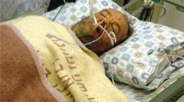 مقدسي يدخل في غيبوبة بعد اعتداء مستوطنين عليه