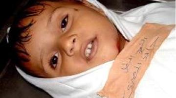 استشهاد فتى فلسطيني من مخيم الجلزون شمال رام الله متأثراً بإصابته برصاص الاحتلال