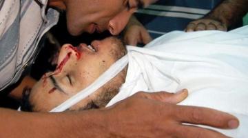 شهيد و10 إصابات في قصف صهيوني لدراجة نارية غرب غزة