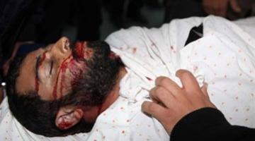 استشهاد مقاوم وإصابة آخر في غارة صهيونية شرق رفح