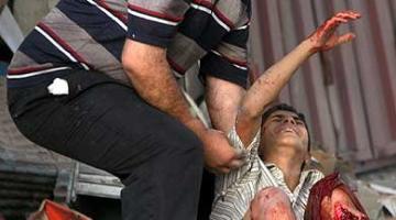 استشهاد شاب متاثرا بجراح اصيب بها قبل 8 سنوات