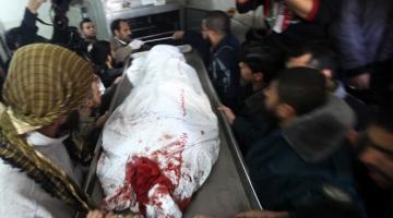 شهيد وإصابات في سلسلة الغارات المستمرة