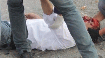 إصابة شاب بجراح خطيرة برصاص حارس صهيوني بالقدس