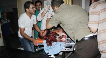 غزة.. حالات بتر وتشوهات غير عادية جراء القصف الصهيوني