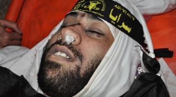 شهيد و خمسة اصابات بانفجار  من مخلفات الحرب شمال غزة