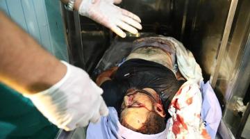 استشهاد شاب من رفح متأثراً بجراحه بالمشافي المصرية