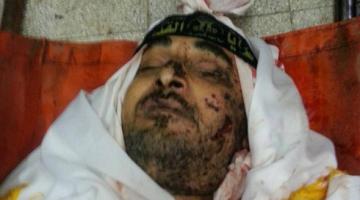 محدث- 45 شهيد خلال العدوان المتواصل على قطاع غزة
