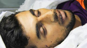 شهيد متأثرا بجراح أصيب بها خلال عدوان غزة