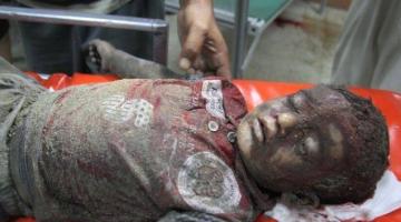 استشهاد طفل بقصف منزله شرق جباليا