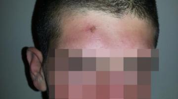 ضابط صهيوني يضرب أحد جنوده ويفقده وعيه خلال عدوان غزة