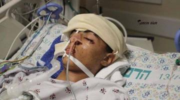 استشهاد فتى متأثراً بجراحه في القدس