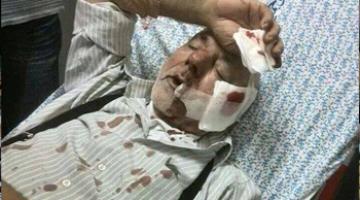 استشهاد مسن مقدسي متأثراً بجراحه قبل 3 شهور