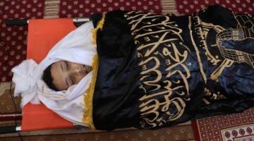 232 شهيداً وأكثر من 1900 جريح جراء العدوان على غزة