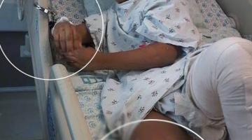 الطفل عيسى مكبلاً في مشافي الاحتلال مع احتمالية بتر قدمه
