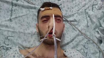 الأسرى المحررون .. ونسيم الحرية القاتل "صور"