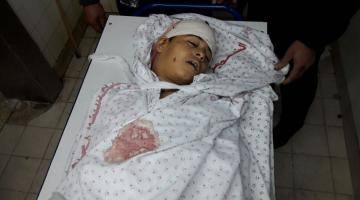 استشهاد طفل متأثراً بإصابته خلال مواجهات "جمعة الشباب الثائر"