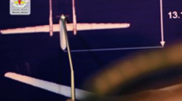 فاصل.. عبقرية الشهادة "عوض القيق"