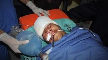 استشهاد شاب متأثراً بجراحه قبل عام في بيت لاهيا