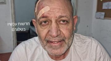 القيادي السعدي يروي تفاصيل الاعتداء عليه من قِبل جنود الاحتلال