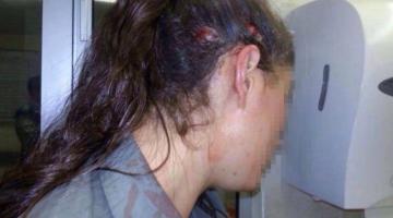 إصابة شرطية صهيونية بالقدس المحتلة