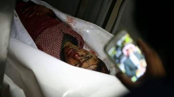 استشهاد فتى متأثراً بجراحه برصاص الاحتلال في رام الله