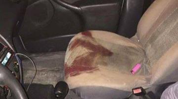 3 إصابات واعتقال شاب بمخيم نور شمس في طولكرم