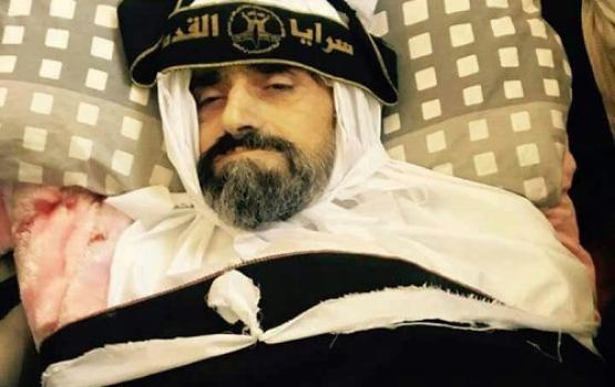 زياد شعيبات ‫(1)‬
