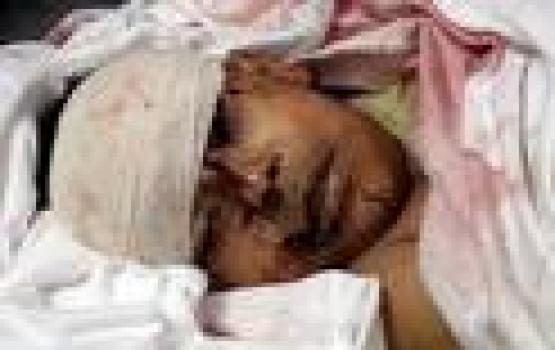 مصادر طبية: استشهاد فلسطيني متأثرا بجراحه التي اصيب بها في الحرب على غزة