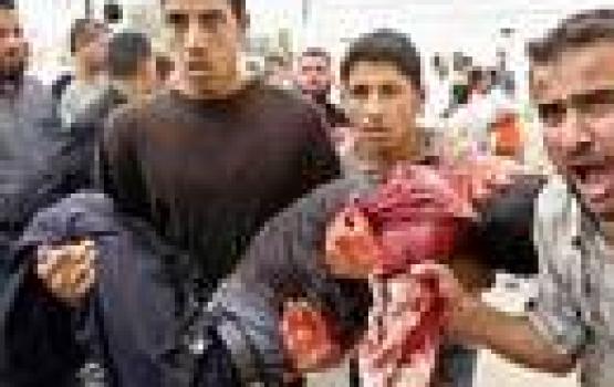 قوات الاحتلال تصيب أربعة مواطنين بجروح خطيرة في مسيرة نعلين غرب رام الله