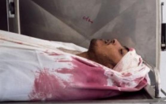 الشهيد " أمجد أبو خضير" ارتقي إلي العلا شهيداً برصاص متطرف صهيوني في مدينة القدس المحتلة