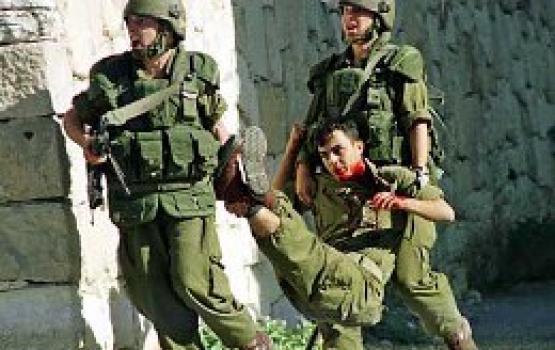 إصابة جندي صهيوني بالحجارة في القدس المحتلة