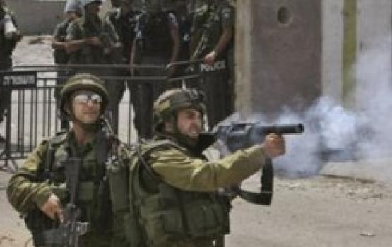 إصابة جندي صهيوني بجراح طفيفة اثر رشقه بالحجارة في القدس