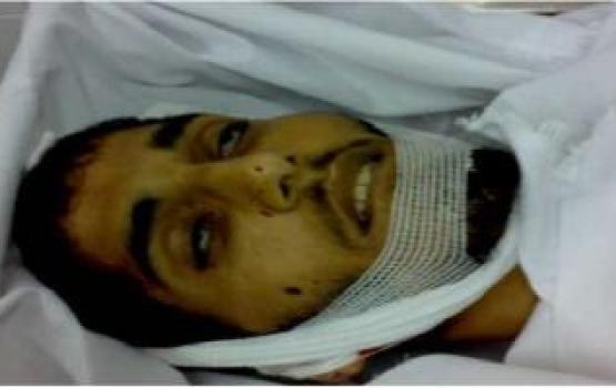 18 شهيداً حصيلة العدوان.. شهيد وإصابات في قصف صهيوني بشمال جنوب غزة