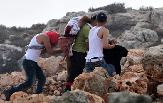 الاحتلال أصاب 50 مواطنا وهجر 13 آخرين خلال اسبوع