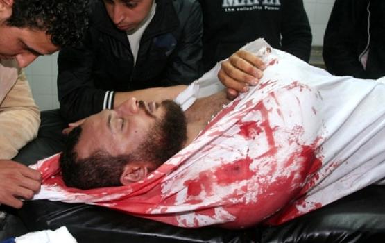 4 شهداء و23 جريحاً بقطاع غزة خلال إسبوع