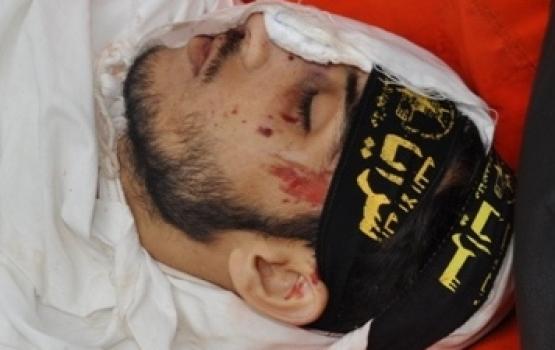 خلال الشهر الحالي..185 شهيداً و1452 جريحاً في قطاع غزة