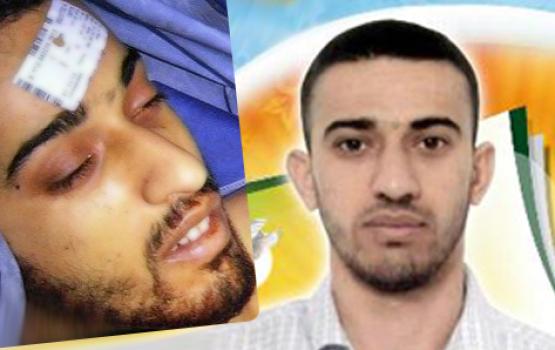 شهيدًا حرًا .. شاهدًا على ظلم العدو.. الأسير حسن الترابي  "صور"