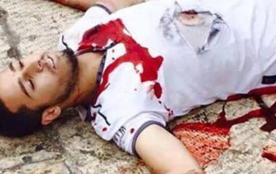 العدو: منفذ عميلة الطعن البطولية في القدس  "حي"