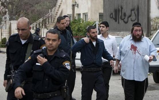 إصابة مستوطن بالحجارة في القدس