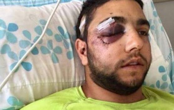 جندي درزي يفقد وعيه تحت الضرب لتحدثه العربية