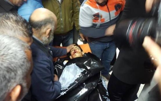 الاحتلال يعدم طفلا ويعتقل آخر ويصيب ثالثا شمال الخليل