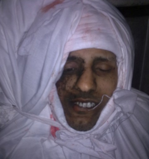 استهداف